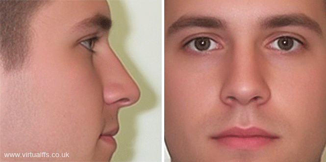 perfect male nose shape